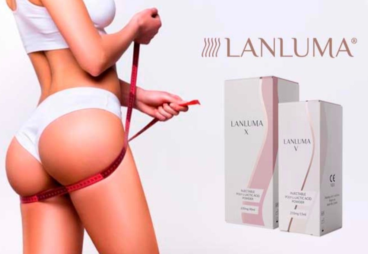 LanLumaX